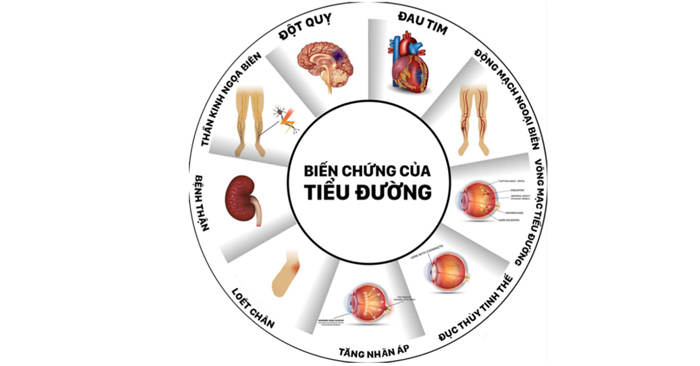 biến chứng tiểu đường