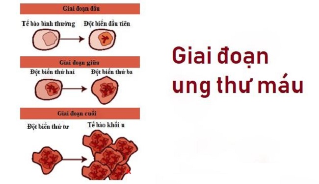 u máu và các giai đoạn