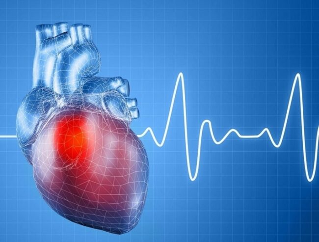 Nhịp tim không đều là biểu hiện cao huyết áp