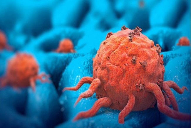 Phương pháp điều trị ung thư mà bạn nên biết