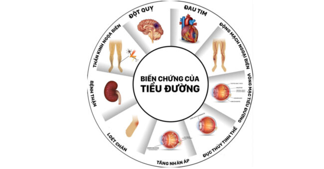 biến chứng của bệnh tiểu đường