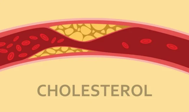 cholesterol_co_tac_dung_gi_va_chung_co_loi_hay_co_hai