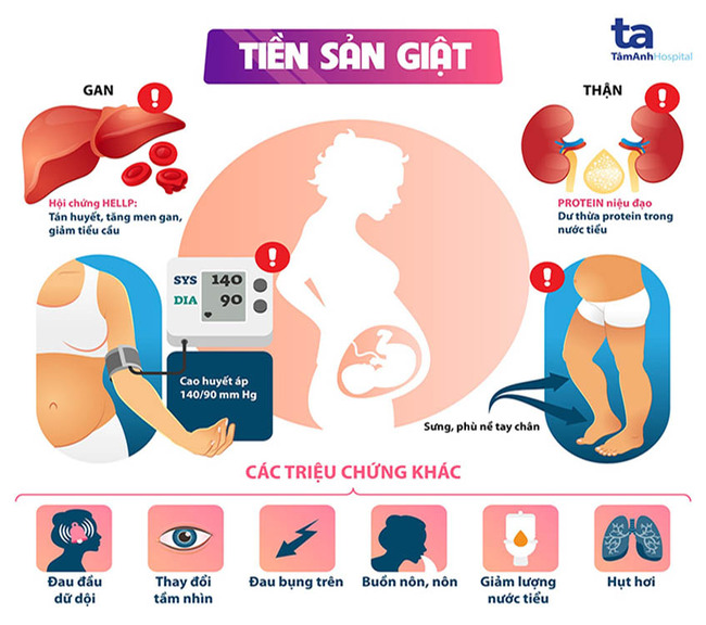 giảm huyết áp trong thai kỳ để tránh tiền sản giật