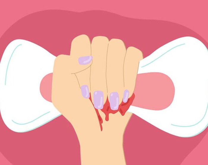 Rối loạn kinh nguyệt