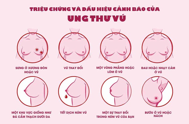  triệu chứng cảnh báo ung thư tuyến vú