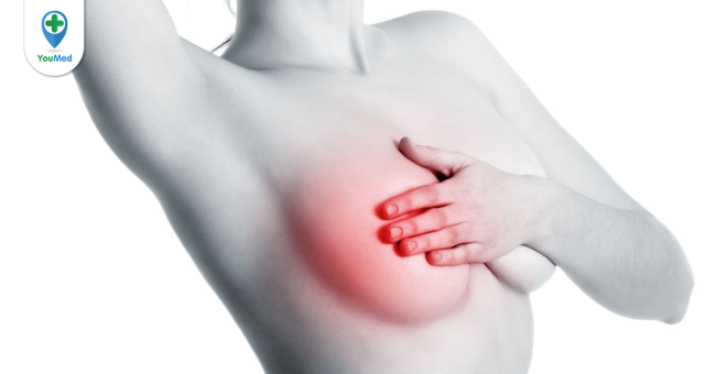 Ung thư tuyến vú