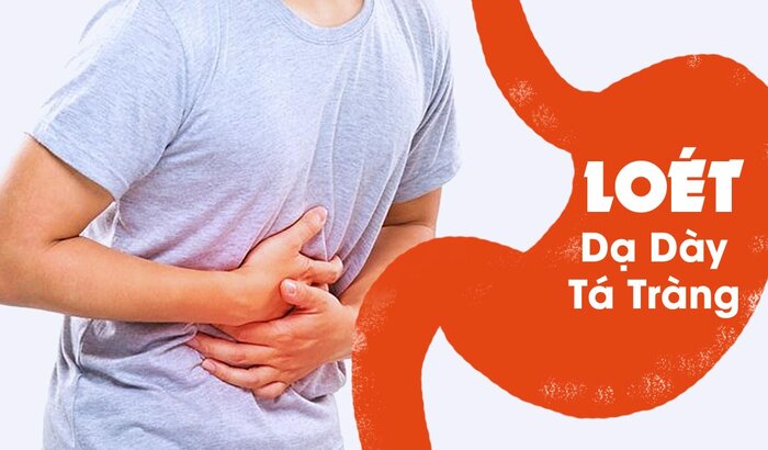 loét dạ dày tá tràng