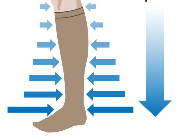 Mang vớ ép y khoa là cách điều trị tụt huyết áp bạn nên biết.