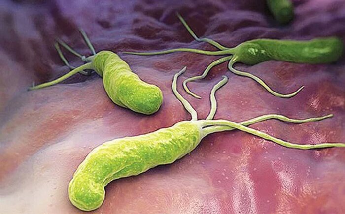 Vi khuẩn Helicobacter pylori chính là nguyên nhân gây loét dạ dày - tá tràng