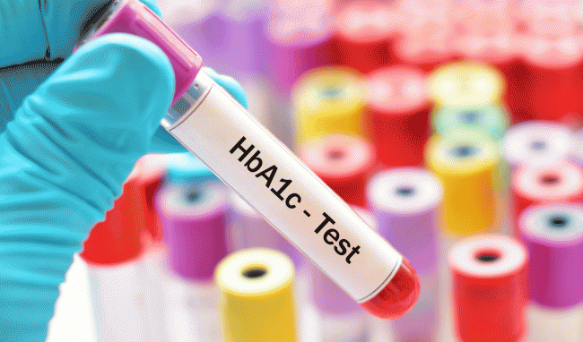 Định lượng HbA1c liệu có cần thiết