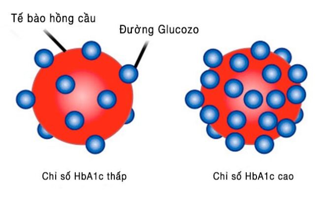 kết quả định lượng HbA1c để chẩn đoán đái tháo đường